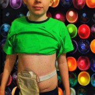 Foto: Junge mit einem Beutel am Bauch