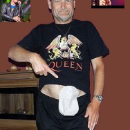 Foto: Queen-Fan zeigt seinen Stoma-Beutel am Bauch