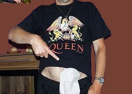 Foto: Queen-Fan zeigt seinen Stoma-Beutel am Bauch
