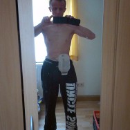 Foto: junger Stomaträger zeigt seinen Beutel am Bauch