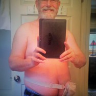 Foto: Stomaträger aus den USA macht ein Selfie und zeigt uns seinen Beutel am Bauch