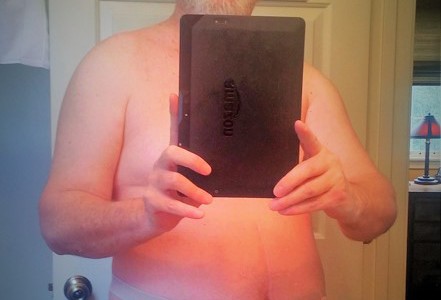 Foto: Stomaträger aus den USA macht ein Selfie und zeigt uns seinen Beutel am Bauch