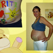 Foto: schwangere Stomaträgerin zeigt ihren Babybauch