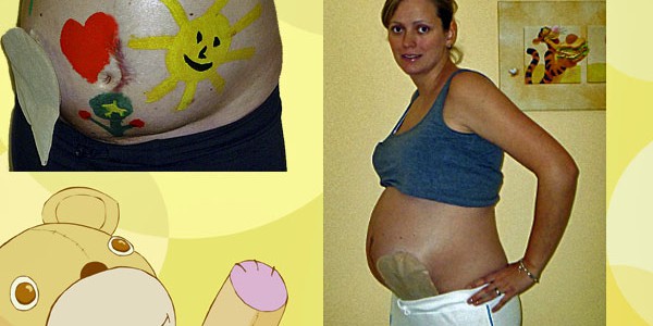 Foto: schwangere Stomaträgerin zeigt ihren Babybauch
