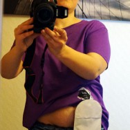 Foto: Stomaträgerin fotografiert sich selbst und zeigt ihren Beutel am Bauch