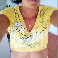 Foto: Stomaträgerin bauchfrei und mit Stomabeutel am Bauch