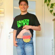 Foto: Fußballfan zeigt seinen Fan-Stomabeutel am Bauch