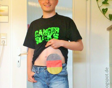 Foto: Fußballfan zeigt seinen Fan-Stomabeutel am Bauch