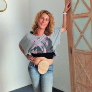 Foto: Junge Frau zeigt ihren Stomabeutel am Bauch