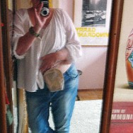 Foto: Stomaträgerin zeigt ihren Stomabeutel am Bauch