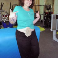 Foto: Physiotherapeutin zeigt ihren Stomabeutel am Bauch