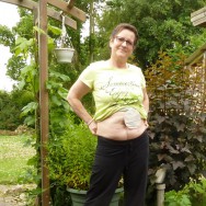 Foto: Stomaträgerin zeigt ihren Minibeutel am Bauch